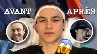 MON OPÉRATION : AVANT / APRÈS ! 