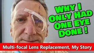I Had Multifocal Lens Eye Surgery and This is the Result!