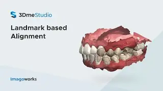 Landmark based Alignment | Imagoworks Technology (2021 Jun)