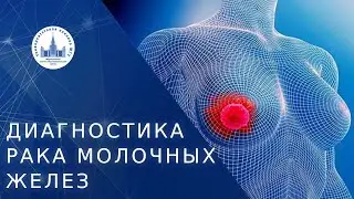 🔬 Методы диагностики рака молочных желез. Диагностика рака молочных желез. МНОЦ МГУ. 18+