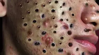 تلميع وتنظيف الجلد الطبيعي المدور 1413589