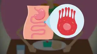 La importancia del control de hidratos de carbono para pacientes con diabetes