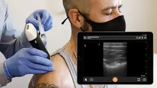 Shoulder Ultrasound Exam