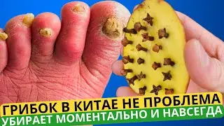 Вот как за 20 мин в китайской народной медицине избавляются от грибка ногтей!