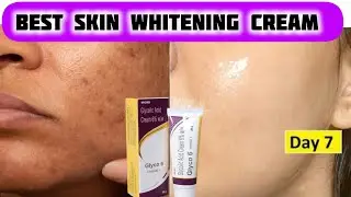काला पड़े चेहरे को गोरा कर देता है| Best skin lightening cream| Glyco 6 cream review| glycolic acid|