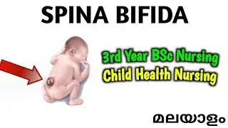 SPINA BIFIDA Explained simply in Malayalam | Neural Tube Defect | Child Health Nursing | BSc Nursing