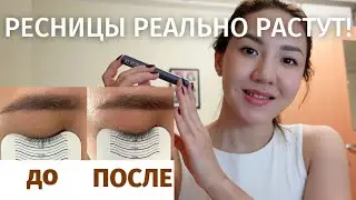 Как отрастить ресницы за месяц | сыворотка для ресниц X-Lash