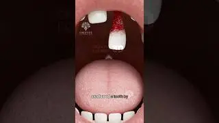 What Happens If You Swallow a Tooth 🦷 