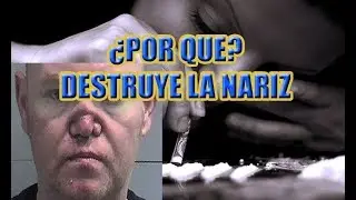 Los efectos de la cocaina en la nariz - 2018