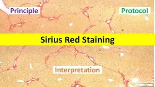 Sirius Red Staining Made Easy: Beginner's Overview | Principle, Protocol & Interpretation Tips |