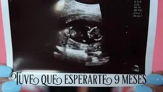 Así nos enteramos de mi embarazo! 💕 LOLA