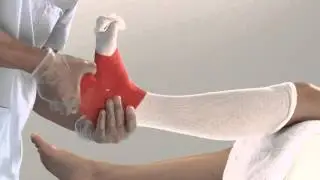Delta-Cast Soft Lower Leg Cast Application