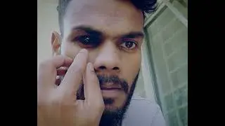 Black Eye VFX | After Effect #vfx | Tonmoy