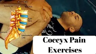 Best Self-Treatment Exercises for Tailbone (Coccyx) Pain or Coccydynia  | Feat. Harbir Singh