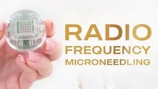 RF Microneedling Explained