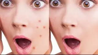En Basit Yüz Temizleme - Photoshop