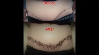 COVER UP SCARS