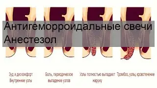 Антигеморроидальные свечи Анестезол