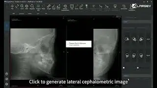 AI analyzes cephalometric data using half cephalometric images