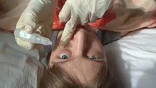 Закапывание капель в глаза