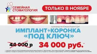 Внимание! Акция имплантация со скидкой 10 000 рублей за зуб в клинике Семейная стоматология в Выборг