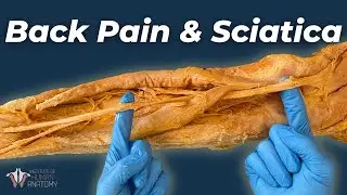The Worst Kind of Back Pain | Herniated Discs & Sciatica