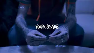 [FREE FOR PROFIT] LIL PEEP X EMO TRAP TYPE BEAT – 