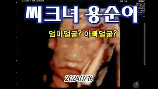[2024.07.16]임신24주 입체초음파