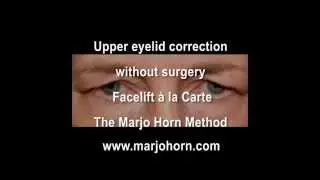 Droopy eyelids. A non surgical solution to repair sagging eyelids.