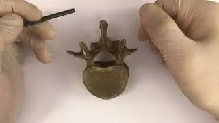 Поясничные позвонки - Vertebrae lumbales