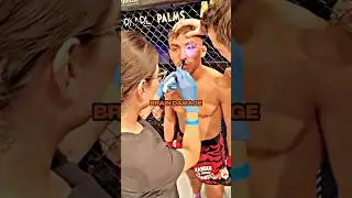 This Is Why Nurses Are Needed In MMA 🤝