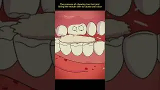 The mouth skin to cause oral ulcer