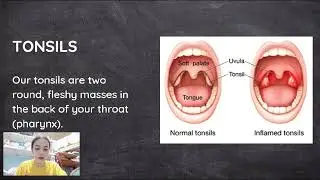 LYMPHATIC SYSTEM (Report)