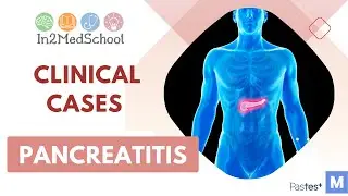 Pancreatitis Clinical Case