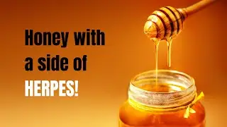 Manuka Honey vs. Genital Herpes and Cold Sores