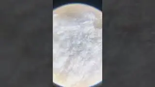 Toothpick 200x zoom 