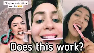 The TikTok Filing Teeth Challenge That Dentists Are Warning About