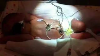2010 11 20 113044 MOV 679