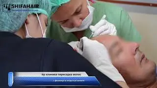 пересадка волос с пациентом из Алматы, свяжитесь с нами 00905522005522