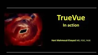 TrueVue"  3D-TEE in action, different scenarios"