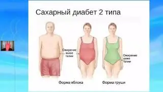 Сахарный диабет и флуревиты  Лекция доктора Засориной Ч 2