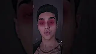her şey üzerime geliyor kimseyle konuşmak istemiyorum Merak etmeyin diye video attım😔😔🤒