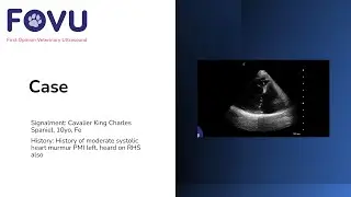 Degenerative Mitral Valve Disease