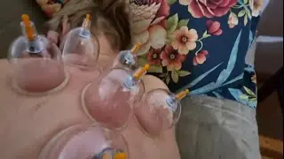Как неправильно поставить банки ? 🤣🤣🤣 Элла Австралия