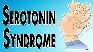 Managing Serotonin Syndrome