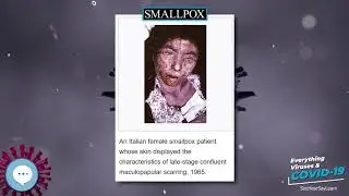 Smallpox 🧫👩🏾‍⚕️🤒 Everything Viruses & COVID-19 🤒👩‍⚕️🧫