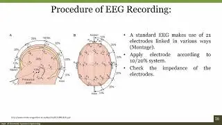 Fundamentals of EEG Signal