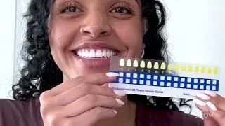 Get Whiter Teeth in 9 Minutes a Day With Snow
