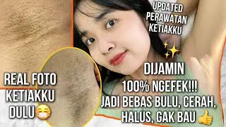 KETIAK ROUTINEKU (JAMIN NGEFEK 100%!) BEBAS BULU PERMANEN,CERAH,MULUS + GAK BAU!