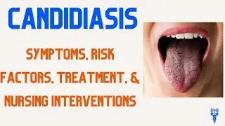 CANDIDIASIS SYMPTOMS, Risk Factors, Treatment, & Nursing Care